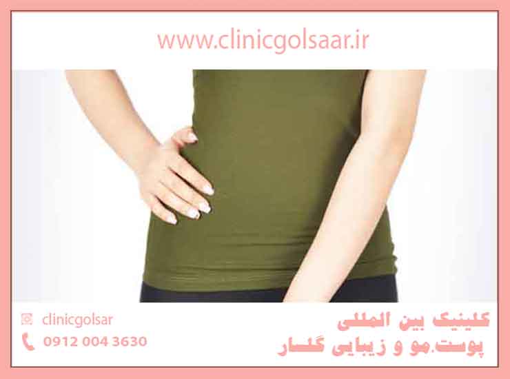 قیمت عمل زیبایی واژن قیمت عمل زیبایی واژن